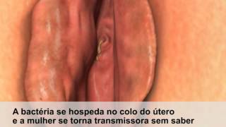 Gonorréia e Herpes Genital