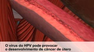 HPV